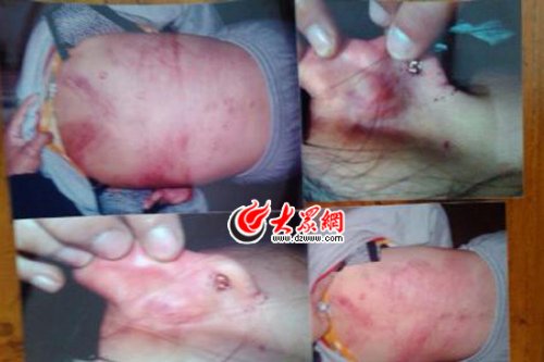 　山東藝術(shù)設(shè)計(jì)學(xué)院16歲女生宿舍內(nèi)被女同學(xué)暴打4小時(shí)。