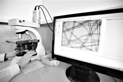 顯微鏡下，聚酯纖維很光亮，表面有斑點(diǎn)，粗細(xì)非常均勻。