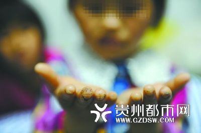 指尖被針扎得傷痕累累。