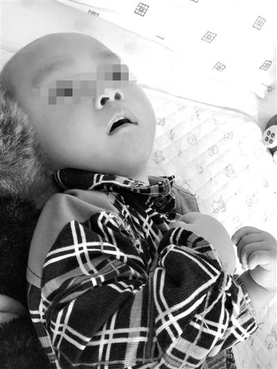 9月10日，陳揚(yáng)躺在醫(yī)院的病床上，他的眼睛仍然沒有聚焦感。新京報(bào)記者 朱柳笛 攝