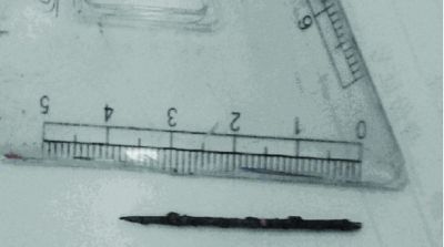 取出的繡花針已發(fā)黑生銹。