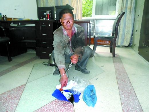   目前張遠已被刑事拘留。