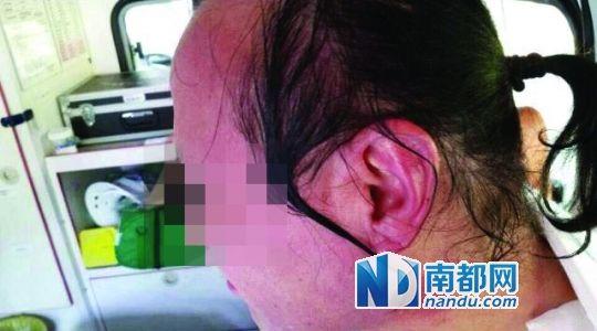 涉事教師遭熱水潑臉后的照片。