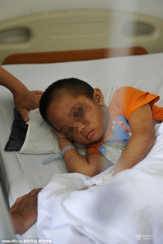 圖為全身傷痕累累的小進(jìn)。