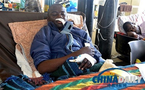 雖然已經(jīng)在醫(yī)院接受了近一個(gè)月的恢復(fù)治療，卡托卡的身體仍然非常虛弱。