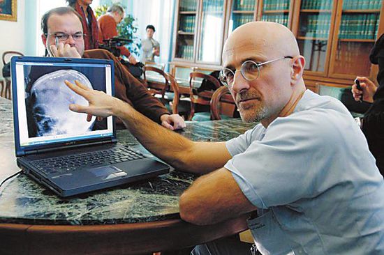 圖為卡納維洛醫(yī)生，不少人認為他的想法非常瘋狂