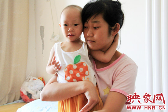 孩子和媽媽在一起，她的右眼已經(jīng)失明。