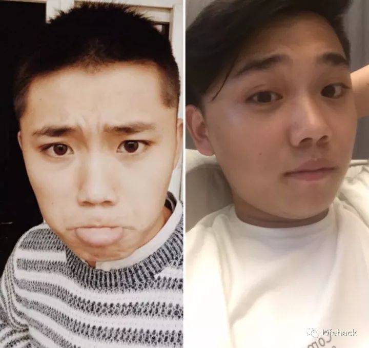 長(zhǎng)胖20斤，臉型怎么變？這些例子看完扎心了！