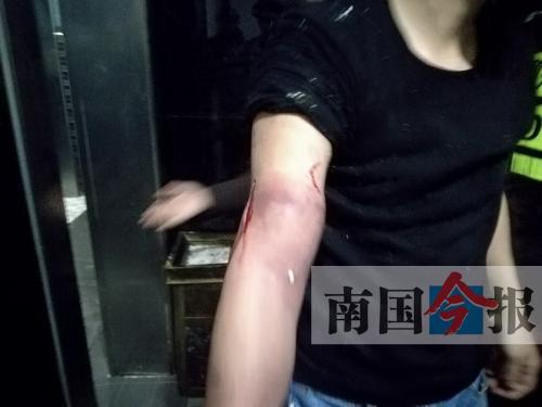 覃先生手臂被卡的部位受傷流血，所幸傷勢(shì)無(wú)大礙。 通訊員 王建民 攝