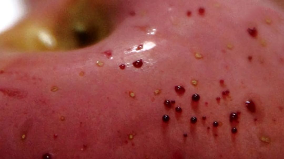 嚇懵！女子用熱水泡蘋果結(jié)果冒出血珠 咋回事？