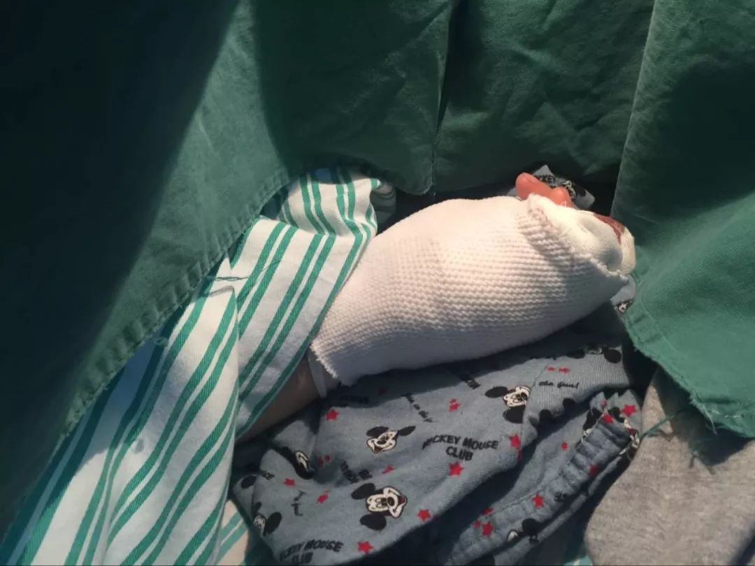 嚇哭！6歲男孩被夾斷手指 罪魁禍首竟是校服