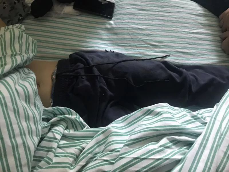 嚇哭！6歲男孩被夾斷手指 罪魁禍首竟是校服