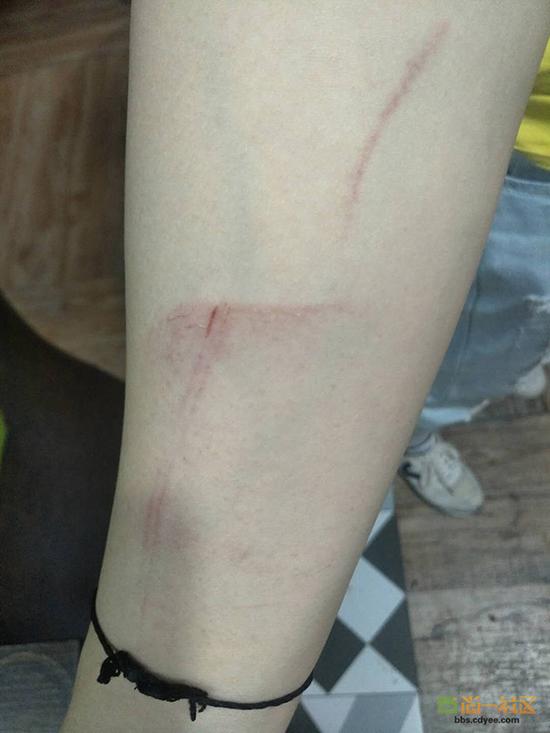 女網(wǎng)友舉報(bào)網(wǎng)帖中出示的被打后照片。