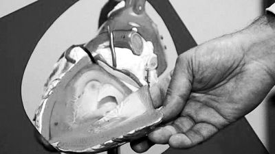 威廉斯領(lǐng)導(dǎo)的研究團(tuán)隊(duì)已經(jīng)利用人體脂肪干細(xì)胞，成功3D打印出心臟血管和心臟瓣膜，待一顆心臟的所有部件打