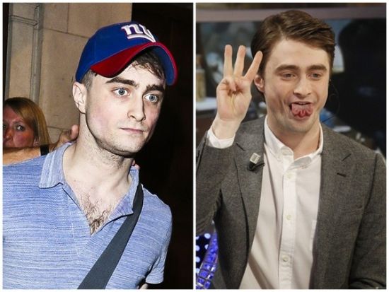 丹尼爾日前被拍到骨瘦如柴，不似2月份健康