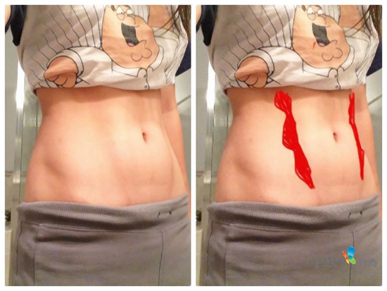 蔡依林 你的馬甲線“脫妝”了！