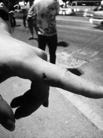 民警食指被咬傷。