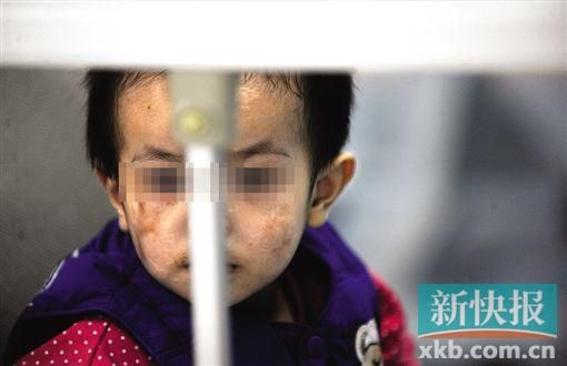 去年3月就能出院的小華(化名),目前還在廣州市婦兒醫(yī)療中心的PICU里住著。新快報(bào)記者 孫毅/攝