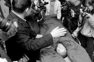 山東女童體內(nèi)12根針成功取出 專(zhuān)家主刀3個(gè)半小時(shí)