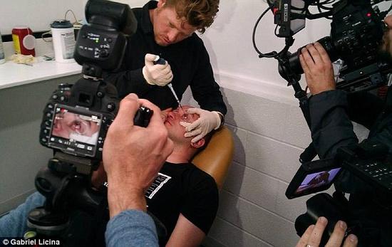 該實(shí)驗(yàn)是由加州一支名為“生物駭客”的實(shí)驗(yàn)團(tuán)隊(duì)開展的。他們使用了一種名為二氫卟吩e6（Ce6）的物質(zhì)的溶液。Ce6常見于深海魚體內(nèi)，有光敏特性，通常用于癌癥治療研究中。研究團(tuán)隊(duì)將Ce6與胰島素和鹽水混合起來，得到一種溶液，可以在低光照條件下提高人類的視力。