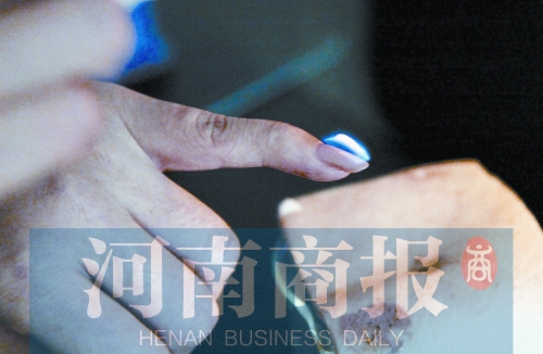 將指甲油涂在指甲上，靠近火焰時被引燃了