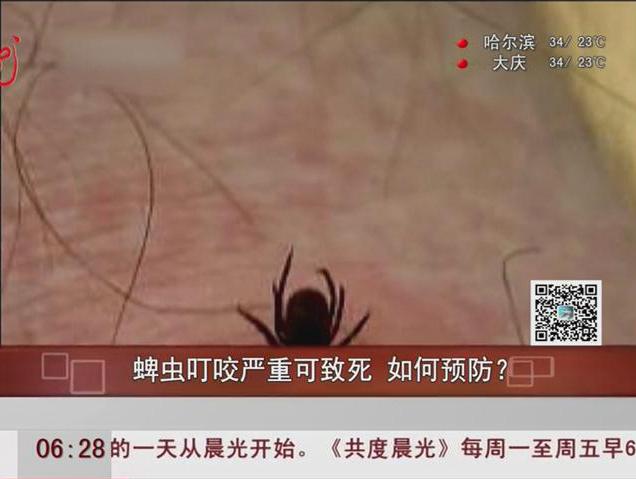 蜱蟲叮咬嚴(yán)重可致死如何預(yù)防？
