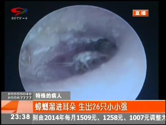 小強(qiáng)溜進(jìn)耳朵？生26只小小強(qiáng)