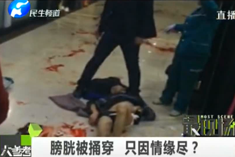 膀胱被捅穿 只因情緣盡？